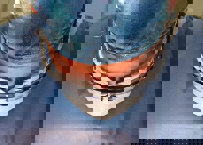 cosmetic_eye_surgery