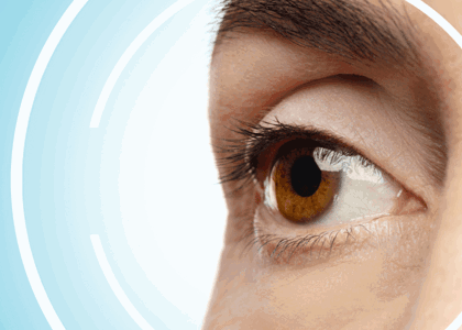 Laser Eye Surgery Keratoconus