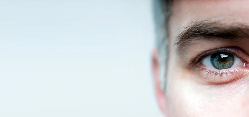 Our 15-Year Guarantee | Terms and conditions | OCL Vision