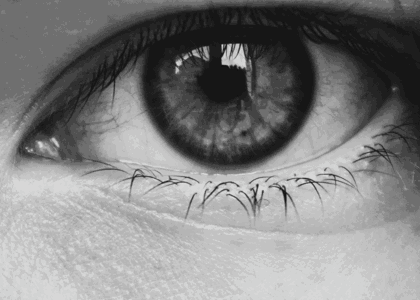 Fuchs Dystrophy Cataract Surgery Corneal Transplantation