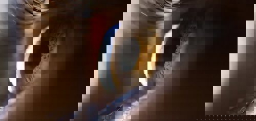 Glasses History to Implantable Lenses Future