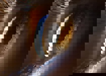 Glasses History to Implantable Lenses Future